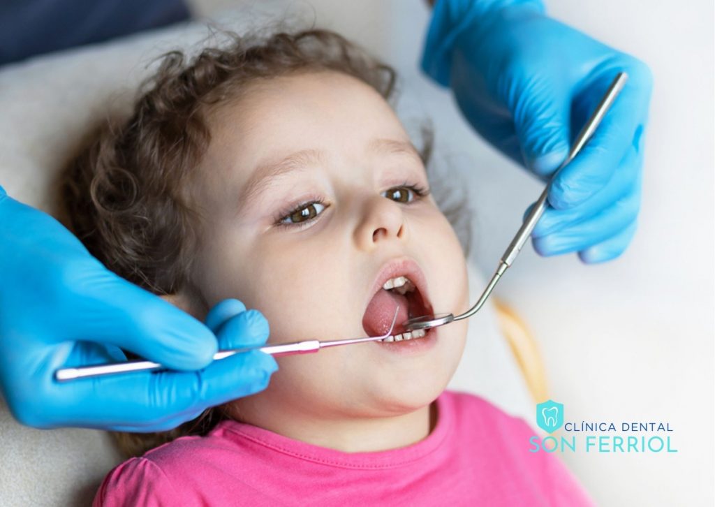 odontopediatria-cuidado-infantil-santos