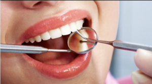 perder-dente-impacta-saude-qualidade-vida-santos