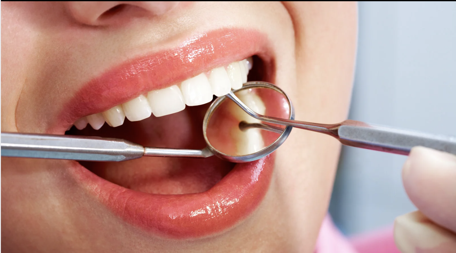 perder-dente-impacta-saude-qualidade-vida-santos