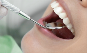 diagnostico-odontologico-preciso-planejamento-dental