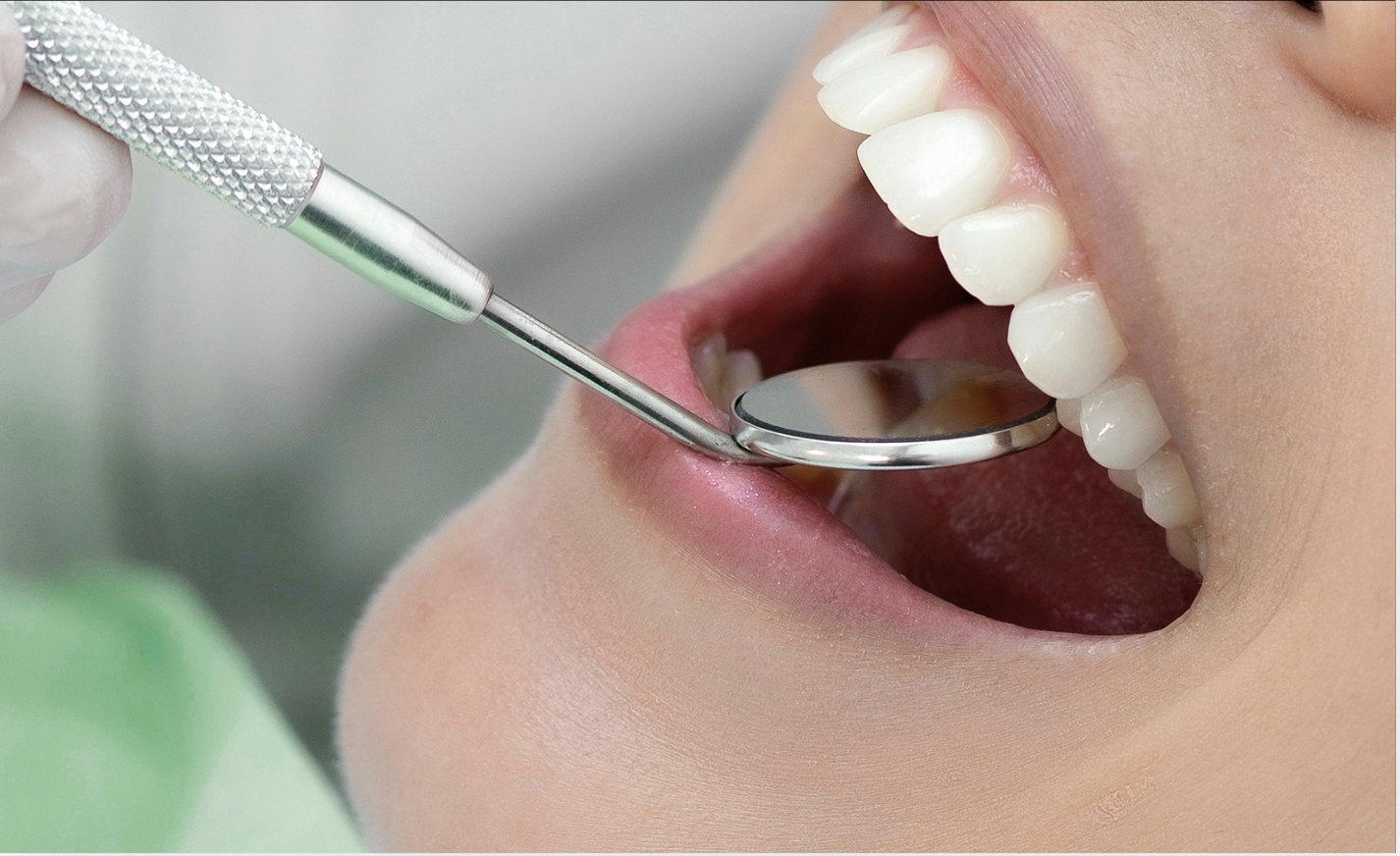 diagnostico-odontologico-preciso-planejamento-dental